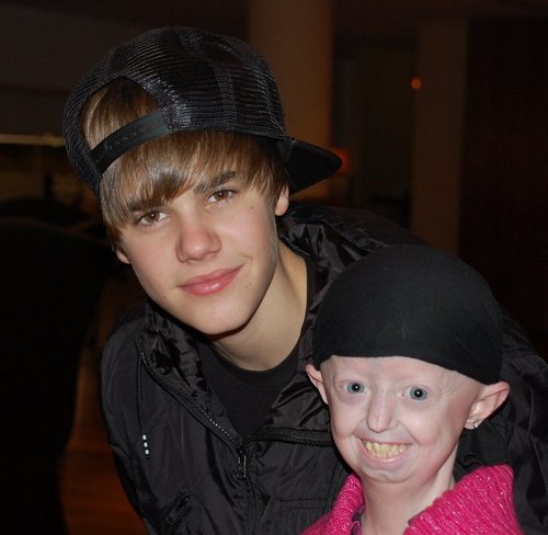 Justin Bieber Meets PROGERIA Sufferer Hayley Okines. (photos under ...